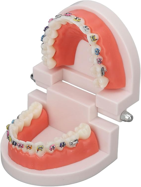 Agatige Dental Teeth Demonstration Model with Orthodontic Bracket, Removable Typodont Teaching Model 28 Teeth, Adjustable 180° Opening Anatomical Teeth Model for Patient Communication