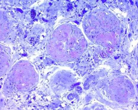 Lieb's Crystal Violet for Amyloid (0.5%), 500ml
