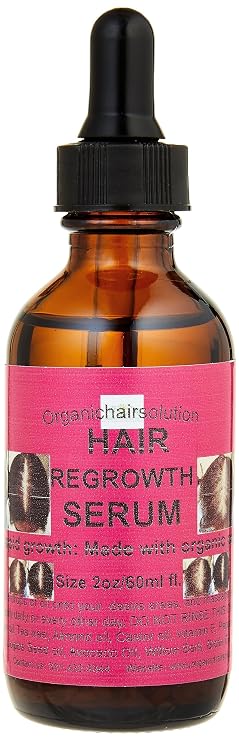 Edge growth Serum- Scalp & Hair Oil-For Strengthening - Growth, Thicker Longer Hair-for Split Ends &Dry Scalp Dandruff- WithPeppermint-Avocado-Castor-Amla- Argan (2oz)
